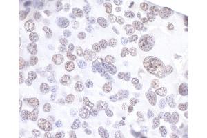Immunohistochemistry (IHC) image for anti-Apoptosis Inhibitor 5 (API5) (AA 1-50) antibody (ABIN7453657)