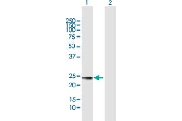 MED18 antibody  (AA 1-208)