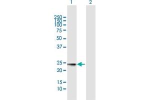 Western Blot analysis of MED18 expression in transfected 293T cell line by MED18 MaxPab polyclonal antibody.
