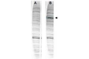 Image no. 2 for anti-Werner Helicase Interacting Protein 1 (WRNIP1) (Internal Region) antibody (ABIN401271) (WRNIP1 antibody  (Internal Region))