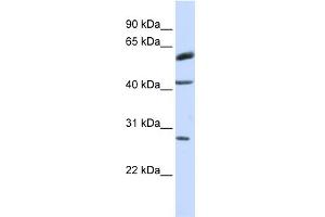 WB Suggested Anti-RNF170 Antibody Titration:  0. (RNF170 antibody  (Middle Region))