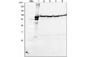Western Blotting (WB) image for anti-Lipoxygenase (LOX) antibody (ABIN125874) (Lipoxygenase (LOX) antibody)