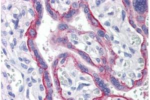 Human Placenta (formalin-fixed, paraffin-embedded) stained with LRRC1 antibody ABIN214508 at 5 ug/ml followed by biotinylated goat anti-rabbit IgG secondary antibody ABIN481713, alkaline phosphatase-streptavidin and chromogen. (LRRC1 antibody  (C-Term))