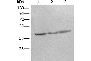 Western blot analysis of Mouse brain tissue Rat heart tissue Rat brain tissue lysates using STOML2 Polyclonal Antibody at dilution of 1:350