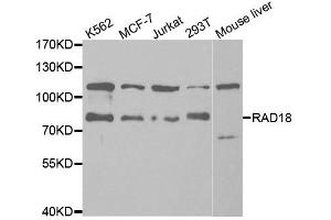 Western Blotting (WB) image for anti-E3 ubiquitin-protein ligase RAD18 (RAD18) antibody (ABIN1876568) (RAD18 antibody)