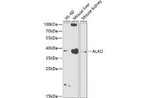 Western blot analysis of extracts of various cell lines, using ALAD antibody (ABIN6129891, ABIN6136749, ABIN6136751 and ABIN6216012) at 1:1000 dilution. (ALAD antibody  (AA 1-330))