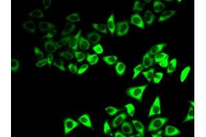 Immunofluorescence analysis of HeLa cells using IGFBP5 antibody (ABIN6130486, ABIN6142258, ABIN6142260 and ABIN6218003).