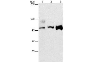 Western Blot analysis of A431, 293T and hela cell using ASCC2 Polyclonal Antibody at dilution of 1:500 (ASCC2 antibody)