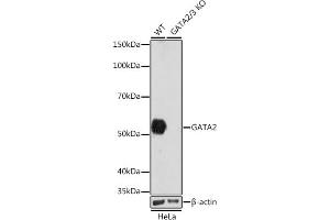Western blot analysis of extracts from wild type (WT) and G knockout (KO) HeLa cells, using G antibody (ABIN7267356) at 1:1000 dilution. (GATA2 antibody)