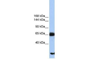 PIGO antibody used at 1 ug/ml to detect target protein. (IGLL1 antibody  (N-Term))