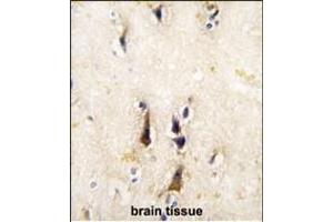 Formalin-fixed and paraffin-embedded human brain tissue reacted with BACE1 antibody (N-term), which was peroxidase-conjugated to the secondary antibody, followed by DAB staining. (BACE1 antibody  (N-Term))