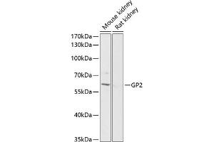 Western blot analysis of extracts of various cell lines, using GP2 antibody (ABIN6131992, ABIN6141289, ABIN6141291 and ABIN6216062) at 1:1000 dilution. (GP2 antibody  (AA 111-387))