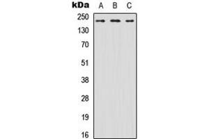 Western blot analysis of Nav1. (SCN8A antibody  (N-Term))