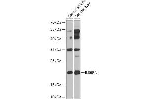 Western blot analysis of extracts of various cell lines, using IL36RN antibody (ABIN6132859, ABIN6142394, ABIN6142395 and ABIN6224229) at 1:1000 dilution. (FIL1d antibody  (AA 1-155))