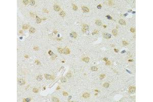 Immunohistochemistry of paraffin-embedded Mouse brain using SLC37A4 Polyclonal Antibody at dilution of 1:100 (40x lens). (SLC37A4 antibody)