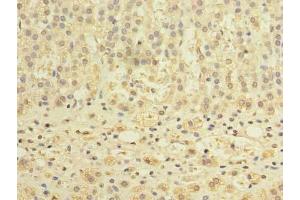 Immunohistochemistry of paraffin-embedded human adrenal gland tissue using ABIN7150898 at dilution of 1:100 (TCTE1 antibody  (AA 285-501))