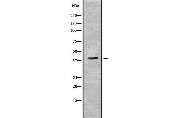 PYGO2 anticorps  (N-Term)
