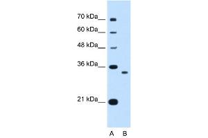WB Suggested Anti-NDRG2 Antibody Titration:  0.