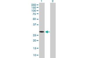 Western Blot analysis of MED6 expression in transfected 293T cell line by MED6 MaxPab polyclonal antibody. (MED6 antibody  (AA 1-246))