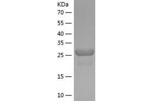 Western Blotting (WB) image for Zinc Finger Protein 43 (ZNF43) (AA 39-294) protein (His tag) (ABIN7285496) (ZNF43 Protein (AA 39-294) (His tag))