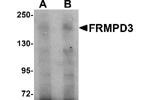 Western Blotting (WB) image for anti-FERM and PDZ Domain Containing 3 (FRMPD3) (Middle Region) antibody (ABIN1030934) (FRMPD3 antibody  (Middle Region))
