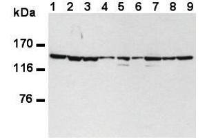 Western Blotting (WB) image for anti-Splicing Factor 3b, Subunit 1, 155kDa (SF3B1) (AA 98-198) antibody (ABIN1449241) (SF3B1 antibody  (AA 98-198))