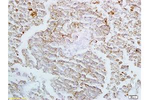 Formalin-fixed and paraffin embedded rat lung labeled with Anti-Claudin-4 Polyclonal Antibody, Unconjugated  at 1:200 followed by conjugation to the secondary antibody and DAB staining (Claudin 4 antibody  (AA 21-120))