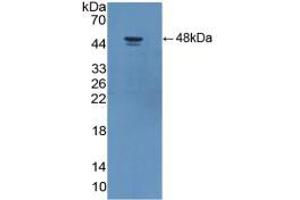 Western blot analysis of recombinant Human ADIPOR2.