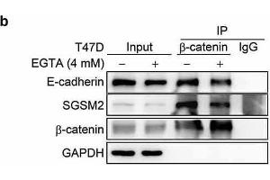 Western Blotting (WB) image for anti-Catenin (Cadherin-Associated Protein), beta 1, 88kDa (CTNNB1) (N-Term) antibody (ABIN2855042)