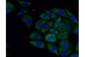 IF analysis of PC-3 cells, using SLN antibody (1/50 dilution) and AF488-conjugated Goat anti-Rabbit IgG (H+L). (SLN antibody)