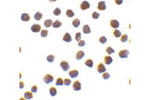 Immunocytochemistry of TRAF6 in K562 cells with this product at 0. (TRAF6 antibody  (C-Term))
