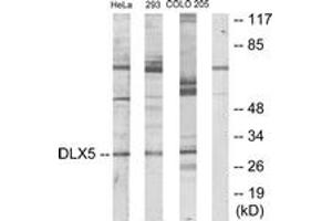 Western blot analysis of extracts from HeLa/293/COLO205 cells, using DLX5 Antibody. (DLX5 antibody  (AA 91-140))