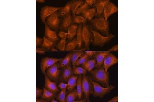 Immunofluorescence analysis of U2OS cells using NCSTN Rabbit pAb (ABIN7268905) at dilution of 1:100. (Nicastrin antibody  (AA 429-669))