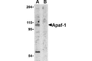 Western Blotting (WB) image for anti-Apoptotic Peptidase Activating Factor 1 (APAF1) (N-Term) antibody (ABIN1031229) (APAF1 antibody  (N-Term))