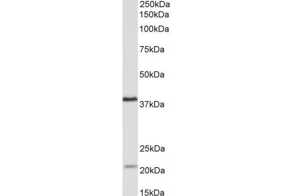 KLHDC8B antibody  (Internal Region)