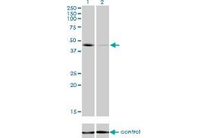 Western blot analysis of T over-expressed 293 cell line, cotransfected with T Validated Chimera RNAi (Lane 2) or non-transfected control (Lane 1). (T Brachyury Protein (AA 222-320) antibody)