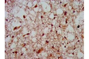 IHC image of ABIN7155717 diluted at 1:800 and staining in paraffin-embedded human brain tissue performed on a Leica BondTM system. (HOXA4 antibody  (AA 23-173))