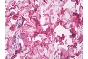 Anti-Collagen V antibody IHC of human skin, dermal collagen.