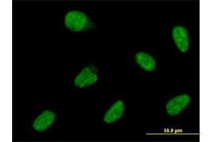 Immunofluorescence of monoclonal antibody to ATOH1 on HeLa cell. (ATOH1 antibody  (AA 266-354))