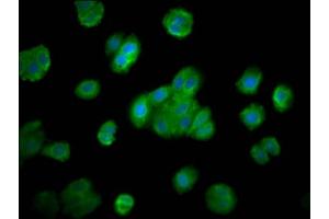 Immunofluorescence staining of HepG2 cells with ABIN7166132 at 1:200, counter-stained with DAPI. (SMG7 antibody  (AA 694-809))