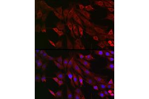 Immunofluorescence analysis of U2OS cells using RMDN3 Rabbit pAb (ABIN6127274, ABIN6146979, ABIN6146981 and ABIN6221512) at dilution of 1:250 (40x lens).