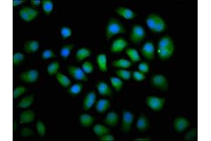 Immunofluorescence staining of Hela cells with ABIN7150781 at 1:66, counter-stained with DAPI. (DUSP6 antibody  (AA 100-206))