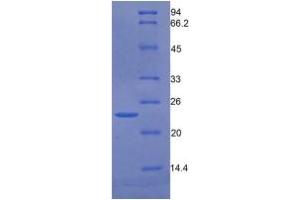 SDS-PAGE of Protein Standard from the Kit (Highly purified E. (GAS6 ELISA Kit)
