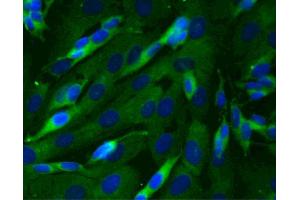 Immunofluorescent staining of SK-N-SH cells (Human neuroblastoma, ATCC HTB-11) (right). (Dynactin 1 antibody  (AA 3-202))