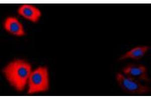 Immunofluorescent analysis of Caspase 1 p10 staining in HeLa cells.
