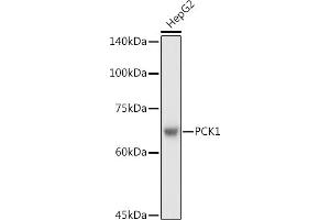 Western Blotting (WB) image for anti-phosphoenolpyruvate Carboxykinase 1 (Soluble) (PCK1) (C-Term) antibody (ABIN3022754)