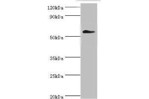 Western blot All lanes: T-complex protein 1 subunit gamma antibody at 12 μg/mL + Mouse brain tissue Secondary Goat polyclonal to rabbit IgG at 1/10000 dilution Predicted band size: 61, 57 kDa Observed band size: 61 kDa (CCT3 antibody  (AA 1-300))