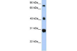FIBCD1 antibody used at 1 ug/ml to detect target protein. (FIBCD1 antibody  (C-Term))