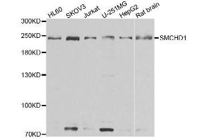 Western blot analysis of extracts of various cell lines, using SMCHD1 antibody. (SMCHD1 antibody  (AA 1756-2005))