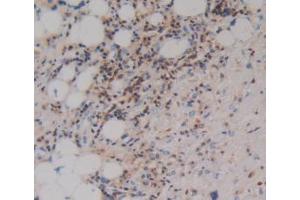Immunohistochemistry (IHC) image for anti-Prothrombin Fragment 1+2 (F1+2) (AA 44-327) antibody (ABIN1173462)